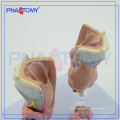 PNT-0757 Thyroid disease model,Thyroid model,Thyroid anatomy model